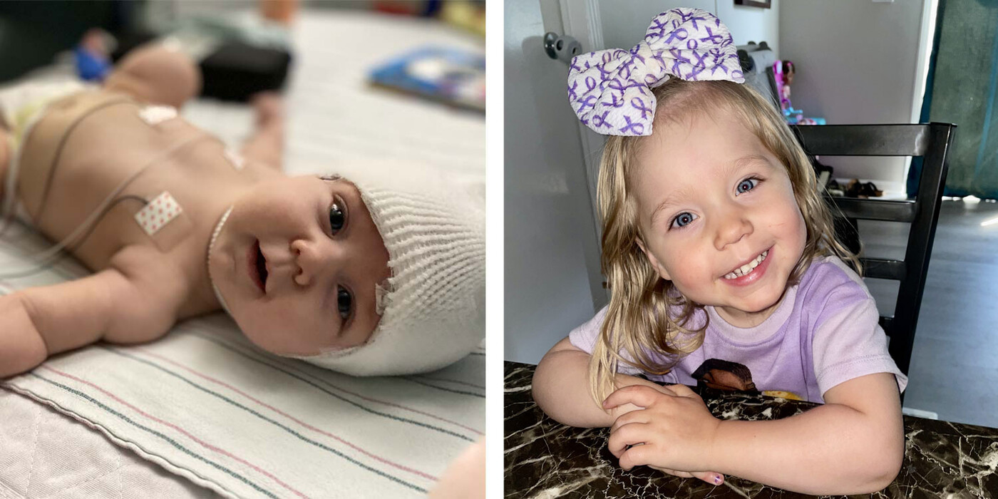 Left: Lily Twiddy during a hospital stay in 2021. Right: Lily at her home in Fayetteville, NC in 2024. Left image, Lily in the hospital as a baby. Right image, Lily smiling while sitting at a table.