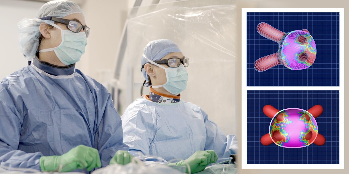 Dr. Piccini, left, uses pulsed field ablation to treat a patient's atrial fibrillation. Pictured right: A hologram image of the heart, which Duke doctors use for guidance during pulsed field ablation procedures. Two doctors operate in an OR to the left, an illustration of the heart on the right