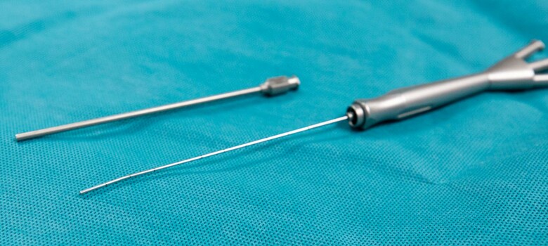 Sialendoscopy Removes Salivary Stones, Spares Glands, Speeds Recovery